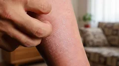 Mikroskopičtí tvorové kolem nás: Kdo se skrývá pod kůží a jak je odhalit