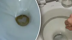 Žluté skvrny zmizí za méně než 1 hodinu: Co nasypat do záchodu