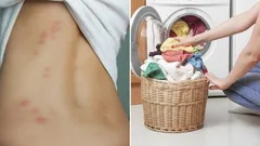 Perete špatně: při jaké teplotě skutečně hynou roztoči prachu?