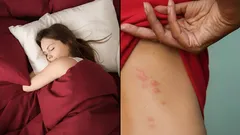 Skrytí škůdci v posteli: jak odhalit a účinně se zbavit roztočů prachových